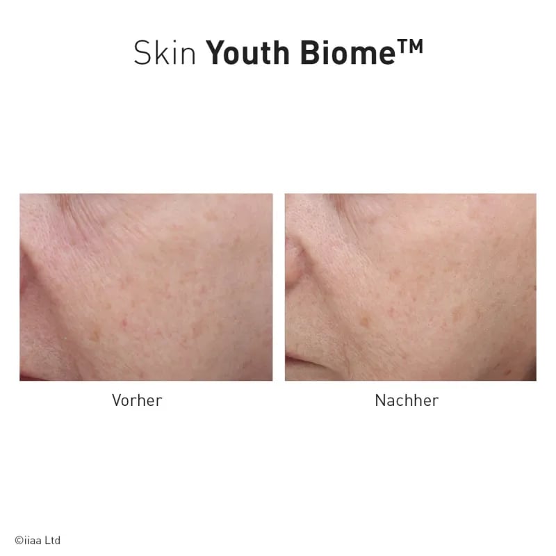 ANP Skin Youth Biome 60 Stck. Nahrungsergänzungsmittel