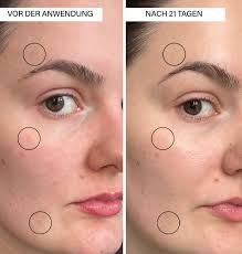 Rosental Brightening Serum I with Vitamin C & Botanics